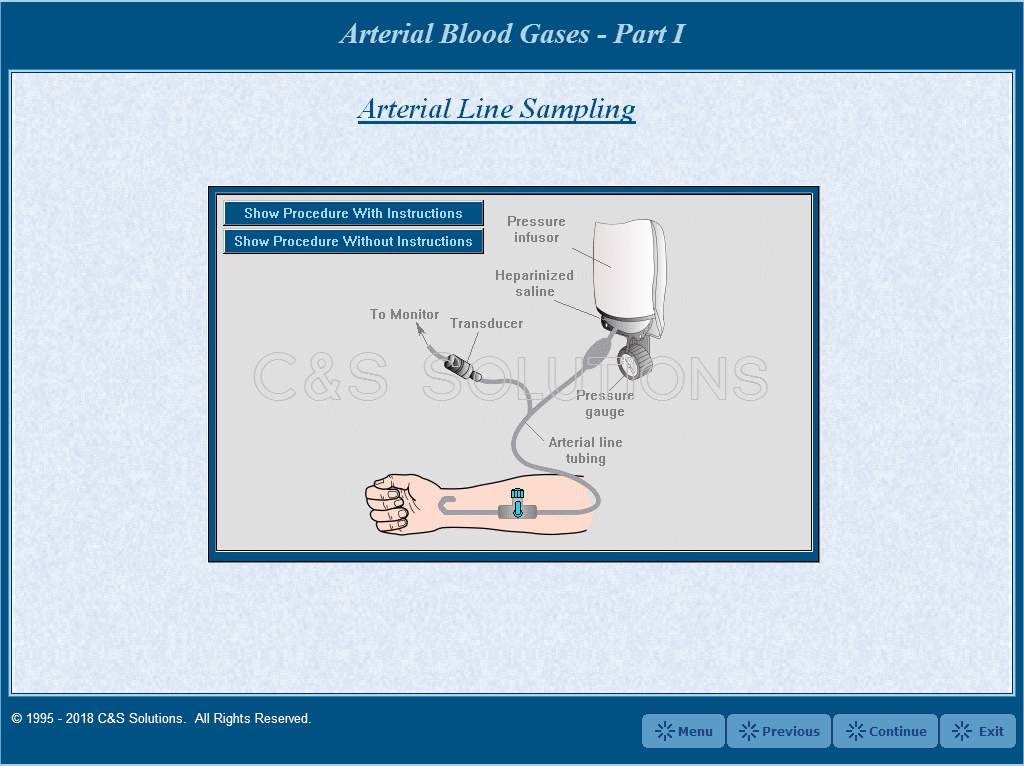 Arterial Blood Gases Part I: Blood Gas Sampling and Interpretation Arterial Line Sampling