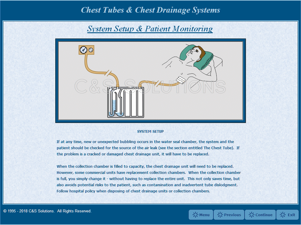 Chest Tubes and Chest Drainage Systems Chest Tube System Setup