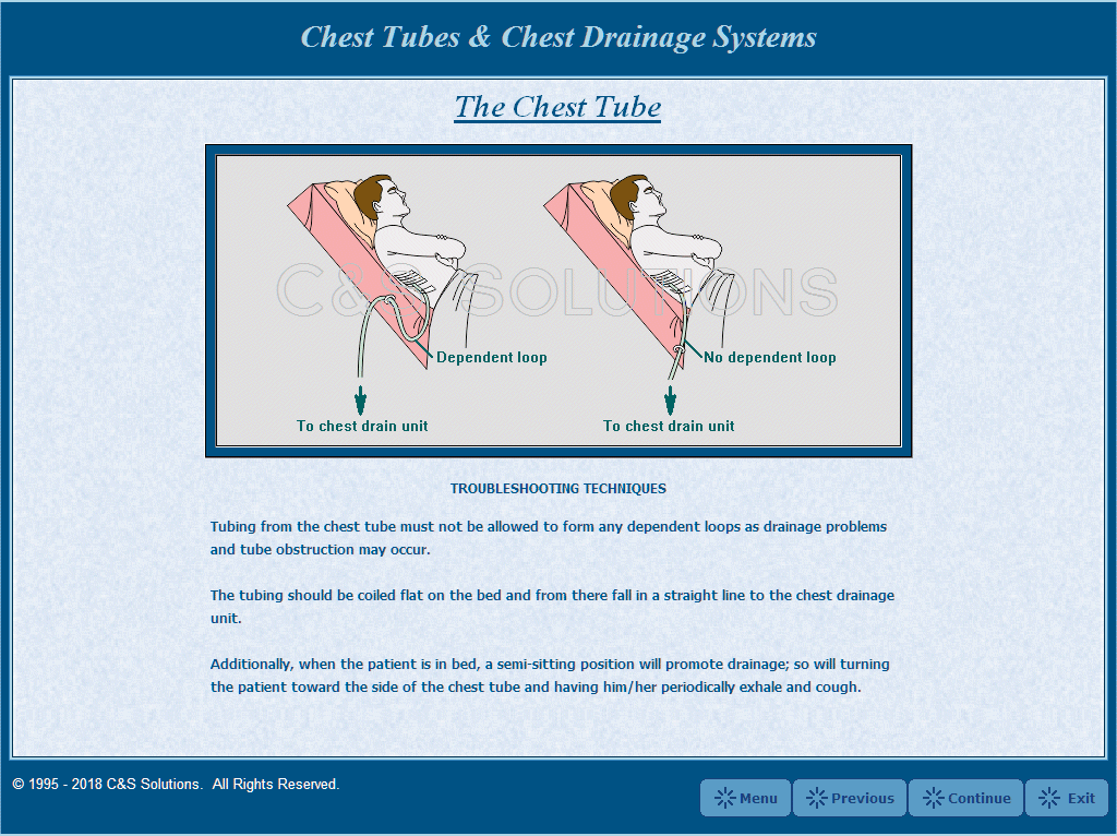 Chest Tubes and Chest Drainage Systems Troubleshooting Techniques