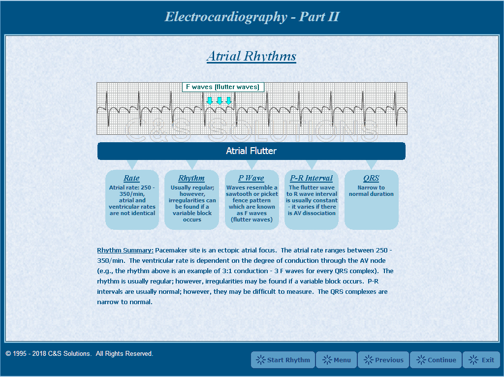 Electrocardiography Part II: Basic Arrhythmia Recognition Atrial Flutter