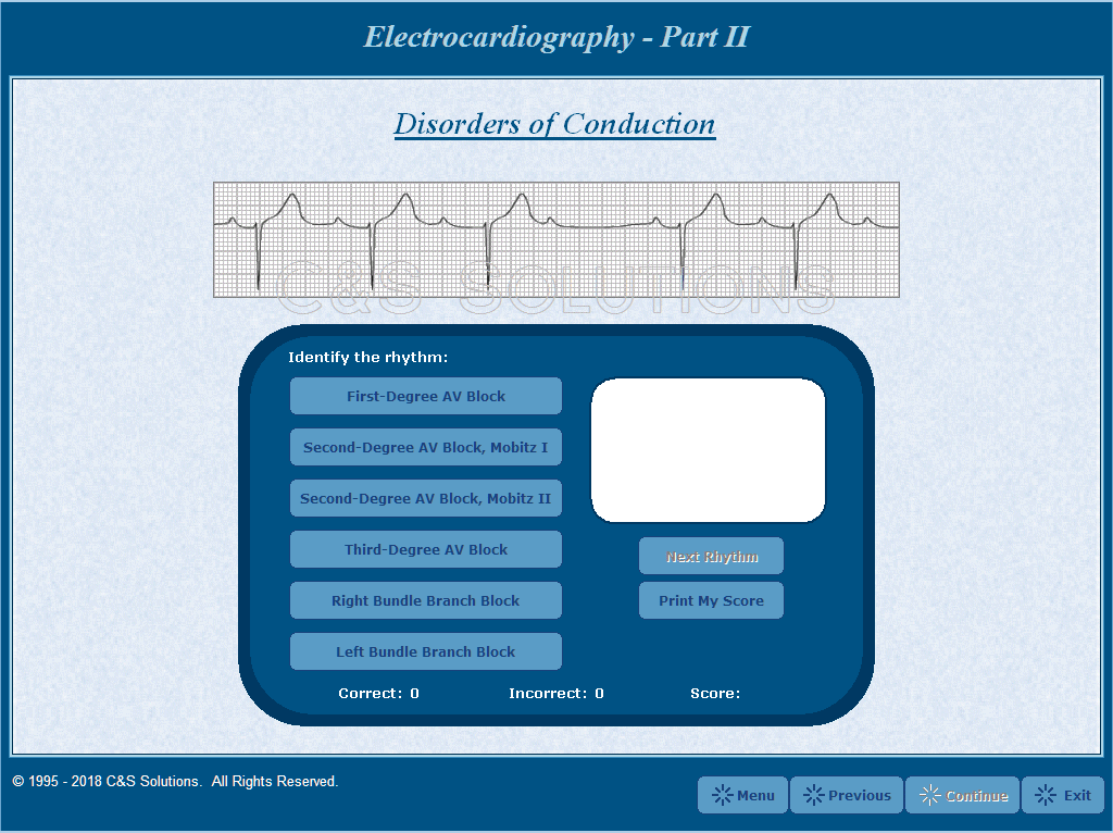 Electrocardiography Part II: Basic Arrhythmia Recognition Practice Identifying Rhythms