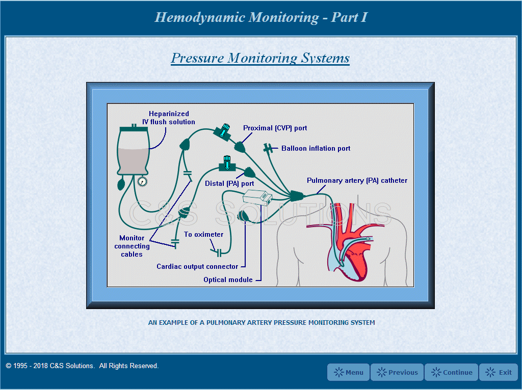 Hemodynamic Monitoring Part I: Waveform Recognition Pressure Monitoring Systems