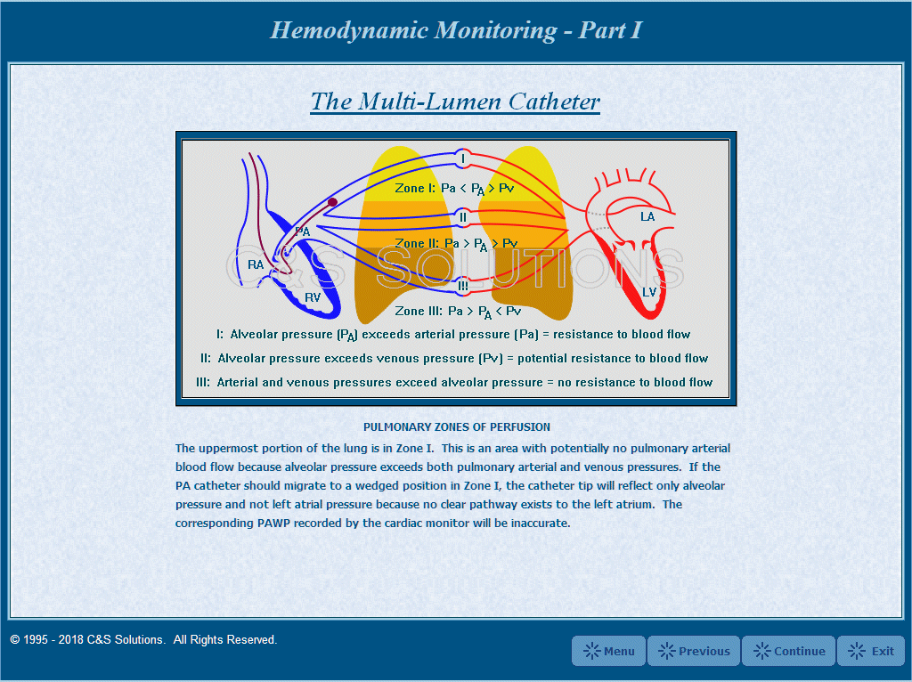Hemodynamic Monitoring Part I: Waveform Recognition Pulmonary Zones of Perfusion