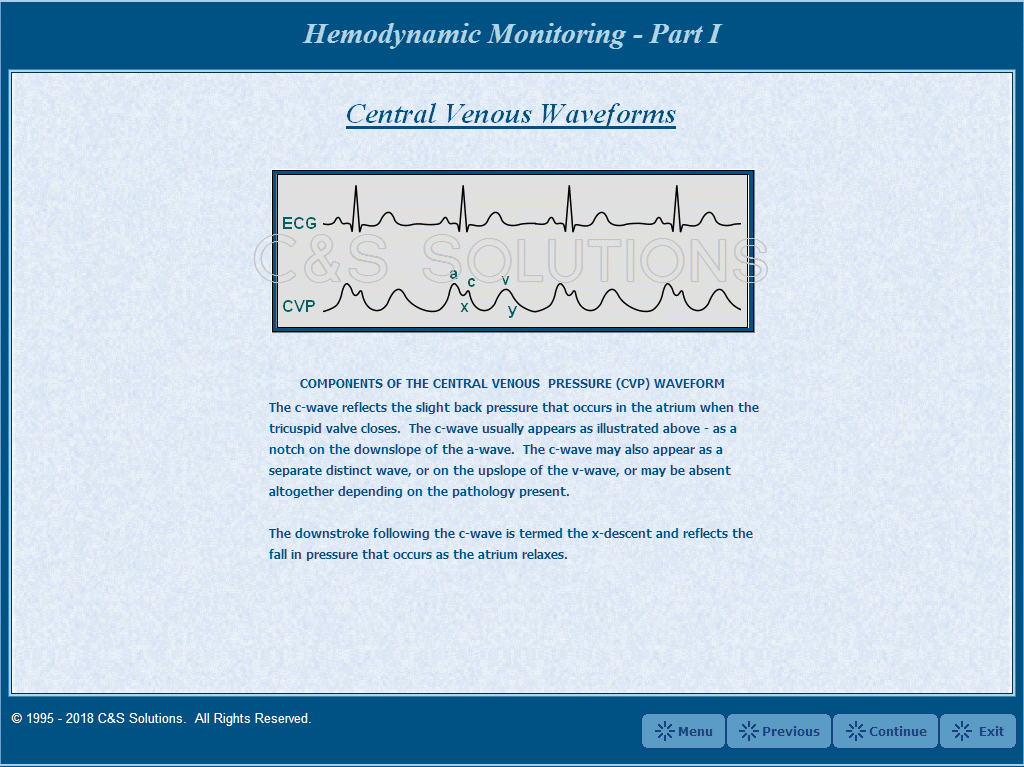 Hemodynamic Monitoring Part I: Waveform Recognition Pulmonary Artery Pressure Waveforms