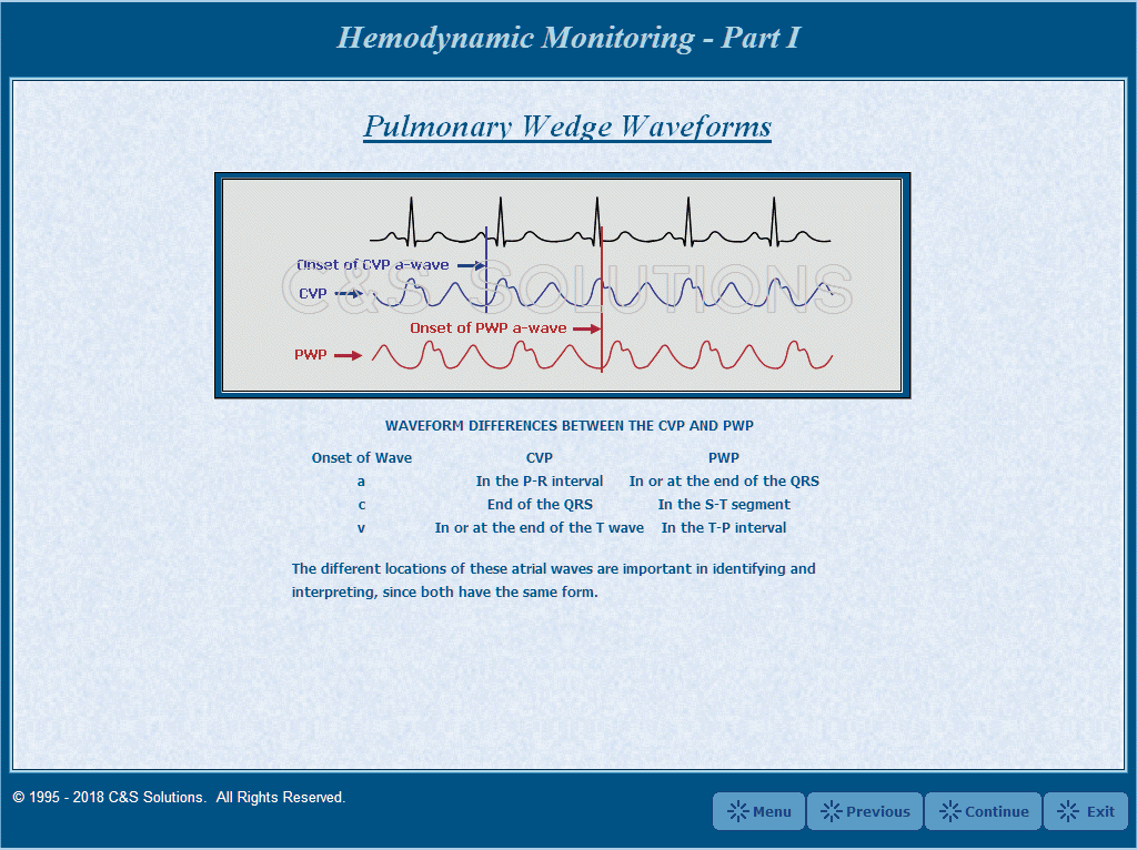 Hemodynamic Monitoring Part I: Waveform Recognition Pulmonary Wedge Pressure Waveforms
