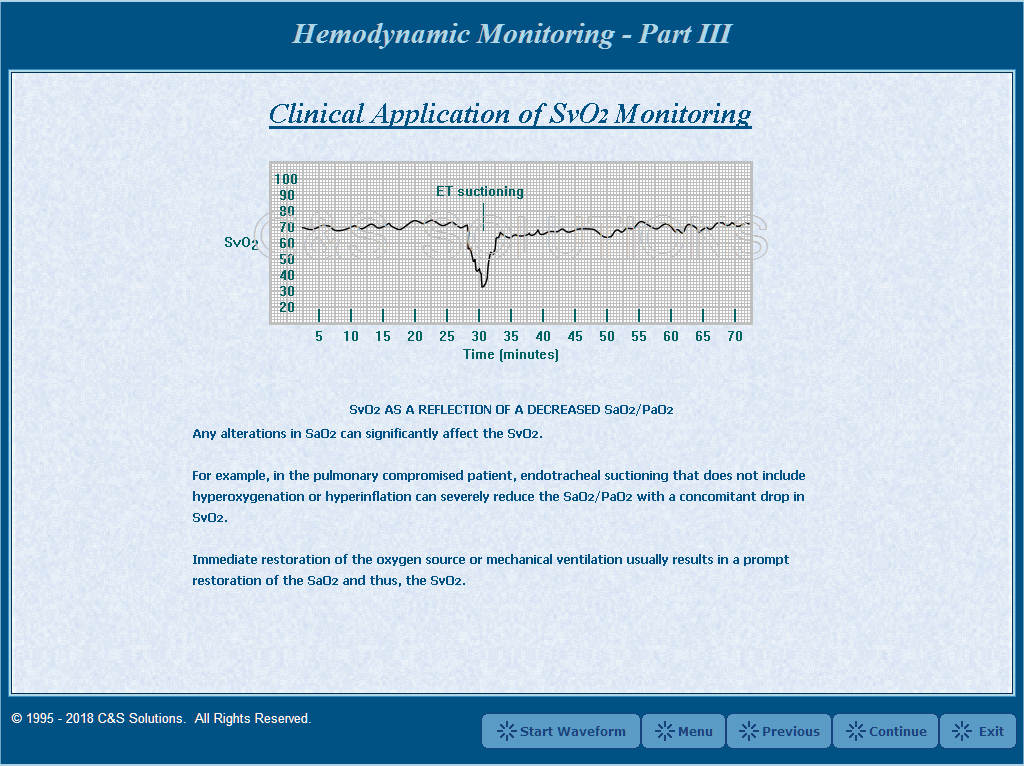 Hemodynamic Monitoring Part III: Continuous SvO2 Monitoring Clinical Application of SvO2 Monitoring