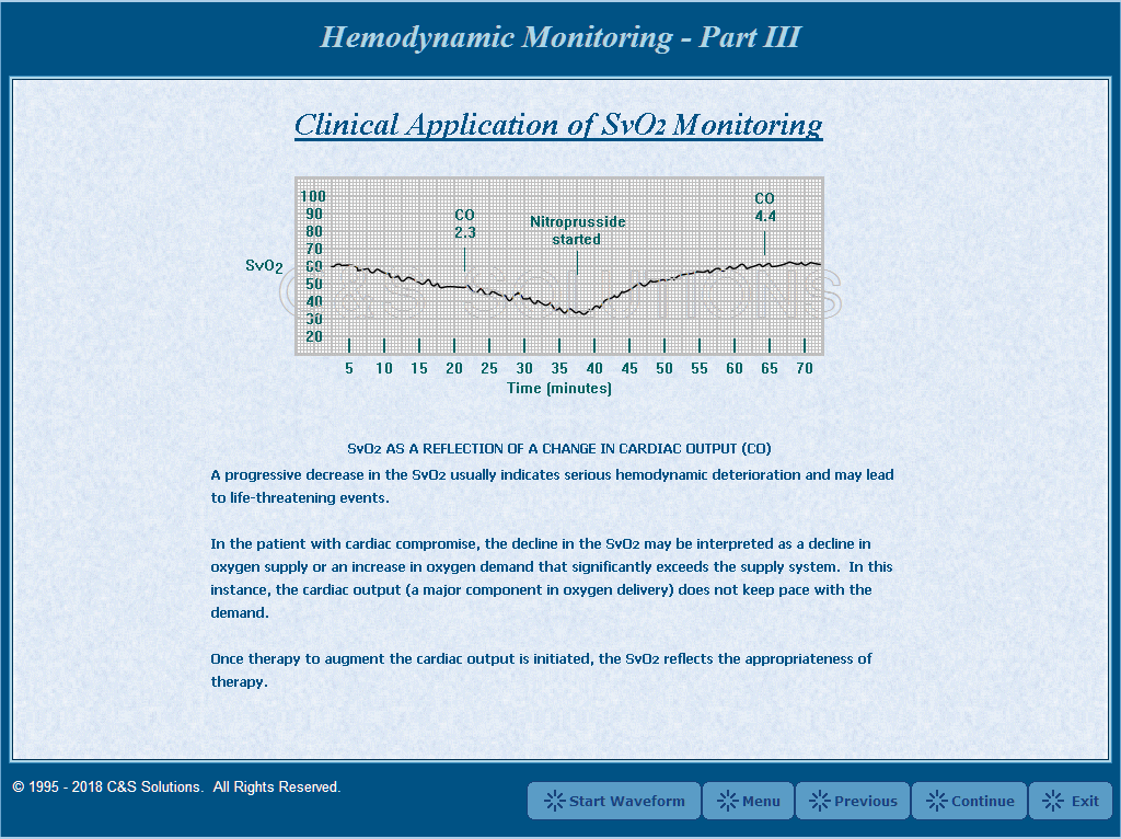 Hemodynamic Monitoring Part III: Continuous SvO2 Monitoring Clinical Application of SvO2 Monitoring